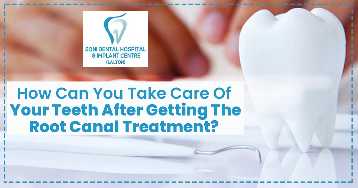 How can you take care of your teeth after getting the root canal treatment